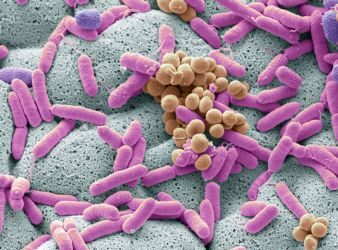 LA IMPORTANCIA DE CUIDAR LA MICROBIOTA EN EL VERANO
